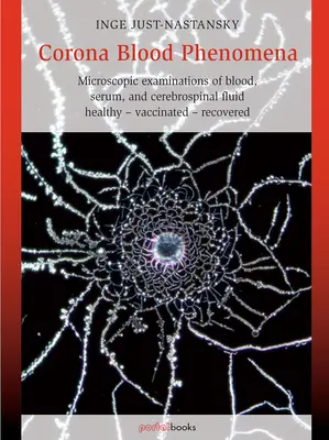 Corona Blood Phenomena: Badania mikroskopowe krwi, surowicy i płynu mózgowo-rdzeniowego: zdrowi - szczepieni - ozdrowieńcy - Corona Blood Phenomena: Microscopic Examinations of Blood, Serum, and Cerebrospinal Fluid: Healthy - Vaccinated - Recovered