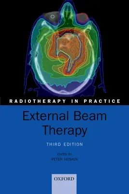 Terapia wiązką zewnętrzną - External Beam Therapy