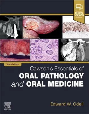 Cawson's Essentials of Oral Pathology and Oral Medicine (Podstawy patologii i medycyny jamy ustnej) - Cawson's Essentials of Oral Pathology and Oral Medicine