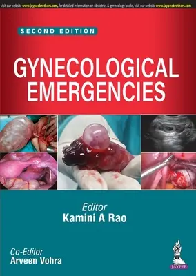 Nagłe przypadki ginekologiczne - Gynecological Emergencies