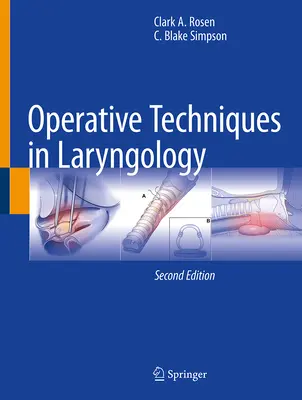 Techniki operacyjne w laryngologii - Operative Techniques in Laryngology