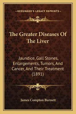 Większe choroby wątroby: Żółtaczka, kamienie żółciowe, powiększenia, guzy i rak oraz ich leczenie - The Greater Diseases Of The Liver: Jaundice, Gall Stones, Enlargements, Tumors, And Cancer, And Their Treatment