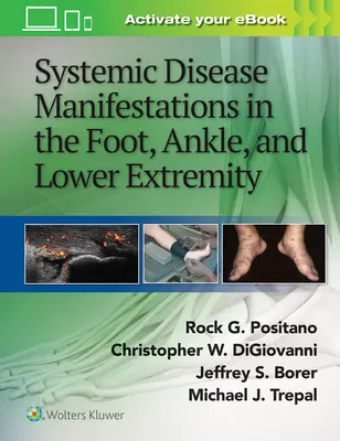 Manifestacje chorób ogólnoustrojowych w stopie, kostce i kończynie dolnej - Systemic Disease Manifestations in the Foot, Ankle, and Lower Extremity