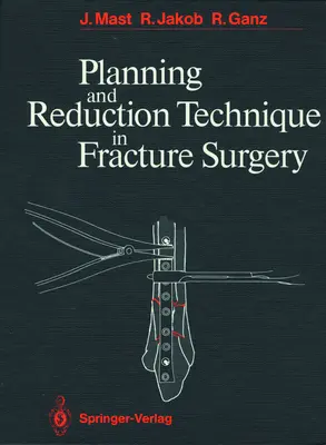 Technika planowania i redukcji w chirurgii złamań - Planning and Reduction Technique in Fracture Surgery