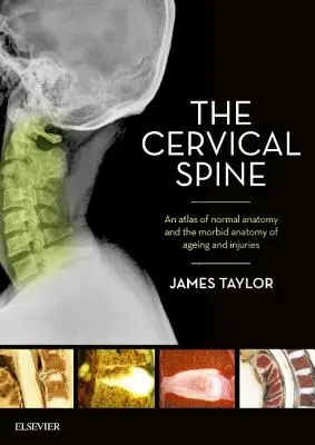 Kręgosłup szyjny: Atlas normalnej anatomii i chorobliwej anatomii starzenia się i urazów - The Cervical Spine: An Atlas of Normal Anatomy and the Morbid Anatomy of Ageing and Injuries