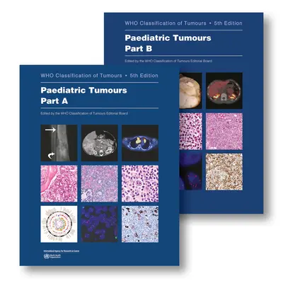 Nowotwory dziecięce: Kto klasyfikuje nowotwory - Paediatric Tumours: Who Classification of Tumours