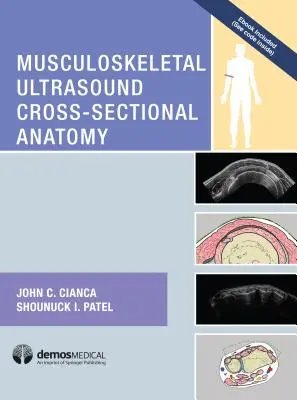 Anatomia przekrojowa ultrasonografii układu mięśniowo-szkieletowego - Musculoskeletal Ultrasound Cross-Sectional Anatomy