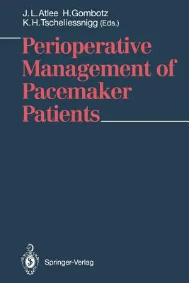 Postępowanie okołooperacyjne z pacjentami z rozrusznikiem serca - Perioperative Management of Pacemaker Patients