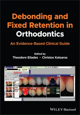 Debonding i stała retencja w ortodoncji: Przewodnik kliniczny oparty na dowodach - Debonding and Fixed Retention in Orthodontics: An Evidence-Based Clinical Guide